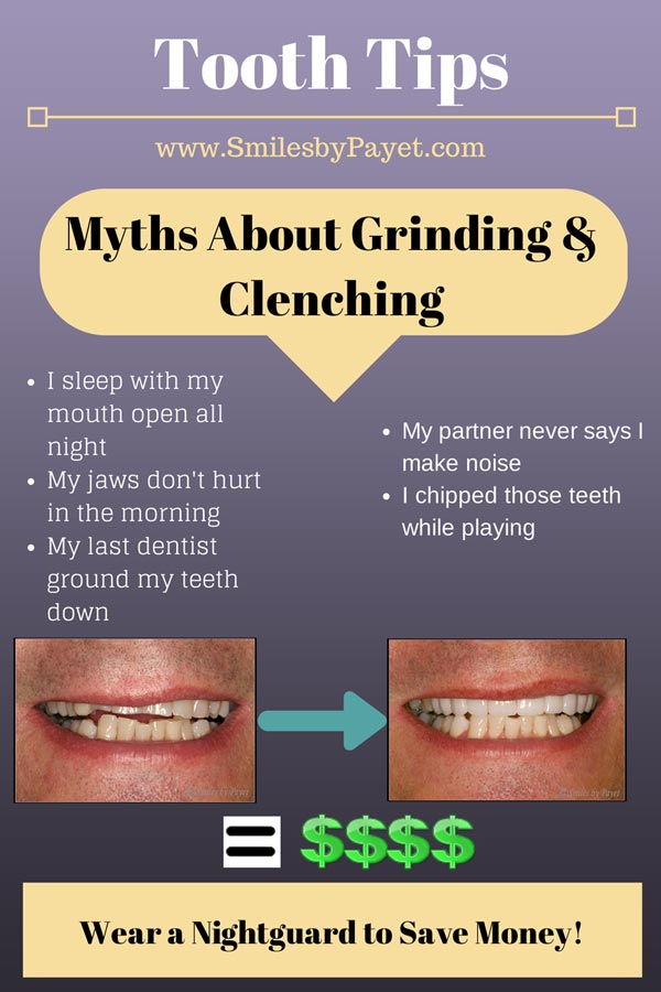 Adult-Tooth-Tip-#1