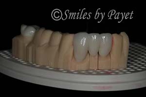 Digtal dentist Charlotte CEREC