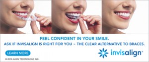 Charlotte NC Invisalign dentist offers Express 5 clear aligners to move teeth fast