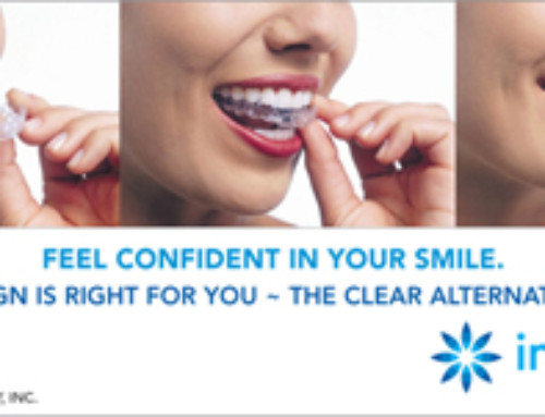 Invisalign Express = Fast Invisalign