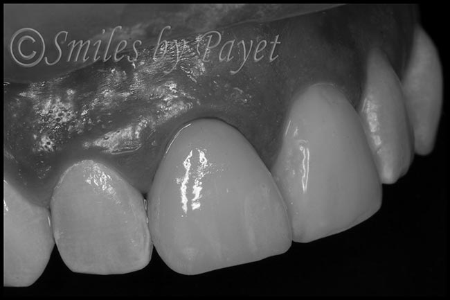 artistic-cosmetic-dentistry-charlotte-matthews-pineville