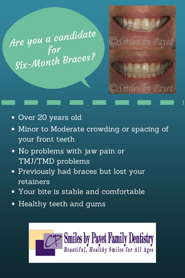Find out if Six Month Braces will work for you