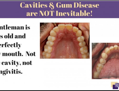 Cavities are Not Inevitable