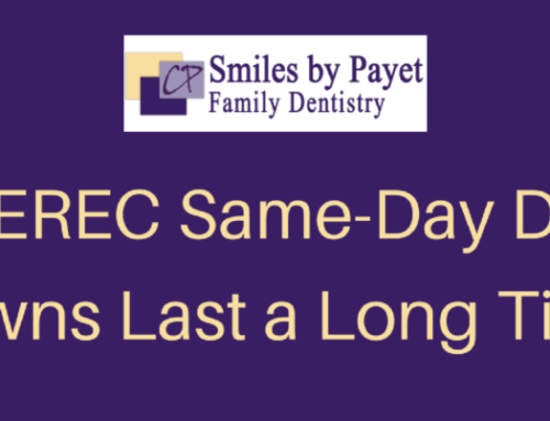 Do CEREC Same-Day Crowns Last a Long Time?